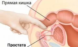 особенности массажа простаты мужчине